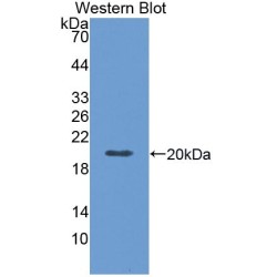 TNF Receptor Superfamily Member 6 / CD95 / TNFRSF6 (FAS) Antibody