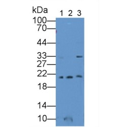 Ferritin, Mitochondrial (FTMT) Antibody