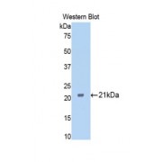 Western blot analysis of recombinant Rat FTMT Protein.