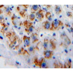 Glycoprotein 5 (GP5) Antibody