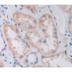 Hepatocyte Growth Factor (HGF) Antibody