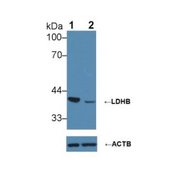 Lactate Dehydrogenase B (LDHB) Antibody