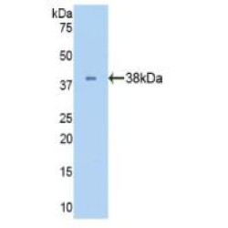Lactate Dehydrogenase B (LDHB) Antibody