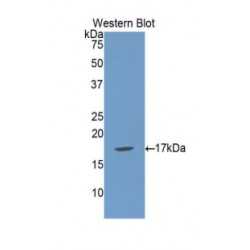 Beta-Microseminoprotein (MSMB) Antibody