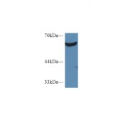 Western blot analysis of Human K562 cell lysate, using Human PKM2 Antibody (2 µg/ml) and HRP-conjugated Goat Anti-Rabbit antibody (<a href="https://www.abbexa.com/index.php?route=product/search&amp;search=abx400043" target="_blank">abx400043</a>, 0.2 µg/ml).