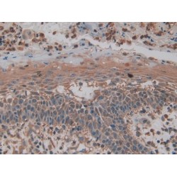 Pyruvate Kinase, Muscle (PKM) Antibody