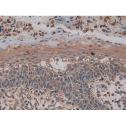 Pyruvate Kinase, Muscle (PKM2) Antibody