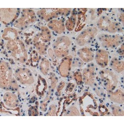 Pyruvate Kinase, Muscle (PKM) Antibody