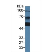 Western blot analysis of Human Jurkat cell lysate, using Human ZBP1 Antibody (2 µg/ml) and HRP-conjugated Goat Anti-Rabbit antibody (<a href="https://www.abbexa.com/index.php?route=product/search&amp;search=abx400043" target="_blank">abx400043</a>, 0.2 µg/ml).