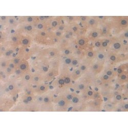 Amyloid Beta 40 (Abeta40) Antibody