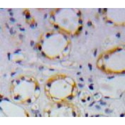 Amyloid Beta 40 (Abeta40) Antibody