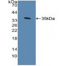Aryl Hydrocarbon Receptor (AhR) Antibody