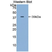 Western blot analysis of the recombinant protein.