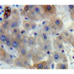 Gamma-Lipotropic Hormone (gLPH) Antibody