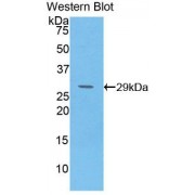 Western blot analysis of recombinant Human GLUD1 Protein.