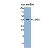 Western blot analysis of the recombinant protein.