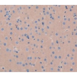 Islet Cell Autoantigen 1 (ICA1) Antibody