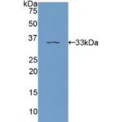 Protein Kinase C Epsilon (PKCe) Antibody