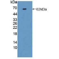 Prothrombin Fragment 1+2 (F1+2) Antibody