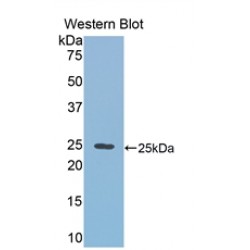 RalA Binding Protein 1 (RALBP1) Antibody