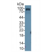 Western blot analysis of Rat Lung lysate, using Rat RALBP1 Antibody (1 µg/ml) and HRP-conjugated Goat Anti-Rabbit antibody (<a href="https://www.abbexa.com/index.php?route=product/search&amp;search=abx400043" target="_blank">abx400043</a>, 0.2 µg/ml).