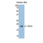 Western blot analysis of recombinant Mouse TCF20.