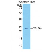 Western blot analysis of recombinant Human DBP.