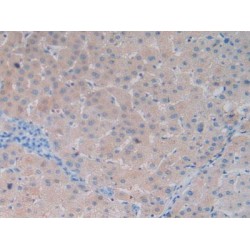 Vitamin D Binding Protein (DBP) Antibody