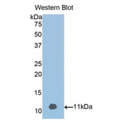 Vitamin D Binding Protein (DBP) Antibody