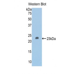 Vitamin D Binding Protein (DBP) Antibody