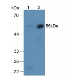 Alpha-2 Antiplasmin (SERPINF2) Antibody