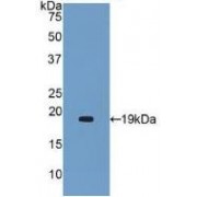 Western blot analysis of recombinant Human a2PI protein.