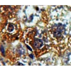 Alpha-Amylase 1 (AMY1) Antibody