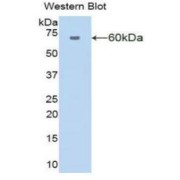 Western blot analysis of the recombinant protein.