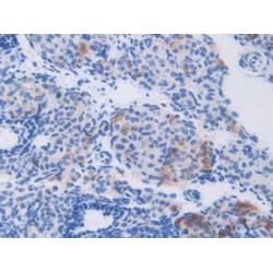 Calpain 1, Large Subunit (CAPN1) Antibody