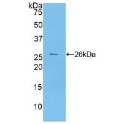 Mucin-16 (MUC16) Antibody