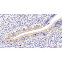 Mucin-16 (MUC16) Antibody