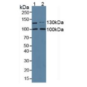 Western blot analysis of (1) Mouse Kidney Tissue and (2) Mouse Placenta Tissue.