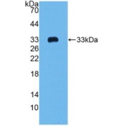 Collagen Type I Alpha 2 (COL1A2) Antibody
