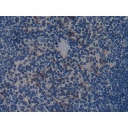 Collagen Type I Alpha 2 (COL1A2) Antibody