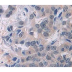 Cyclin Dependent Kinase 1 (CDK1) Antibody