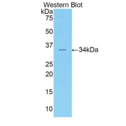 Cyclin Dependent Kinase 1 (CDK1) Antibody