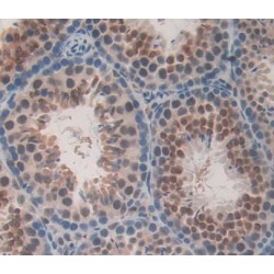 Cyclin Dependent Kinase 1 (CDK1) Antibody