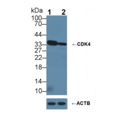 Cyclin Dependent Kinase 4 (CDK4) Antibody