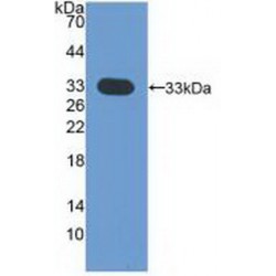 Cyclin Dependent Kinase 4 (CDK4) Antibody