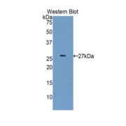 Western blot analysis of the recombinant protein.