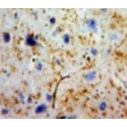 Cyclin Dependent Kinase 5 (CDK5) Antibody