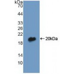 Acyl-CoA-Binding Protein (DBI) Antibody