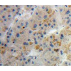 Acyl-CoA-Binding Protein (DBI) Antibody