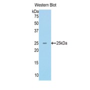 Western blot analysis of the recombinant protein.